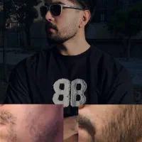 مکمل ریش و سیبیل