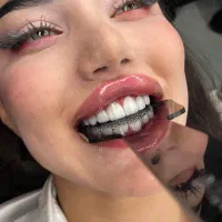 کامپوزیت دندان واحدی 900