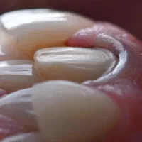 دندانپزشکی|آرایشی، بهداشتی، درمانی|ارومیه, |دیوار