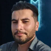 کاشت مو و ابرو با جدیدترین متدهای روز