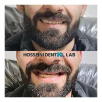 دندانسازی(بلوارهدایت)دندان مصنوعی/دندان سازی|خدمات آرایشگری و زیبایی|مشهد, هدایت|دیوار