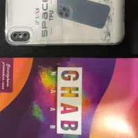 قاب ایفون xs یا xمعمولی