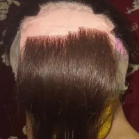 پروتز مو زنانه مردانه|آرایشی، بهداشتی، درمانی|تهران, شهرک ولیعصر جنوبی|دیوار