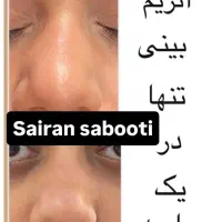 آنزیم بینی گوشتی غبغب پلاسما تراپی|خدمات آرایشگری و زیبایی|شیراز, محراب|دیوار