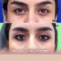 عمل. تزریق چربی صورت بیکینی لابیا پلاستی و بوتاکس|خدمات آرایشگری و زیبایی|رشت, جهاد|دیوار