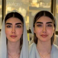 فیلر فول فیس لب مزوتراپی بوتاکس PRP پوست و مو