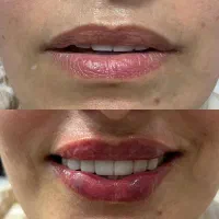 تاریخ تخفیف ۹شهریور فقط یک روزه ۴۵۰هزارتومان|خدمات آرایشگری و زیبایی|رشت, گلسار|دیوار