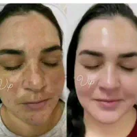 کرم بیوممتیک برند لاکچری کوین