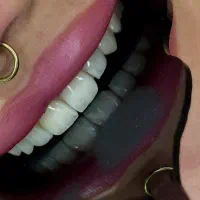 دندانپزشکی دیجیتال اقساطی رشت