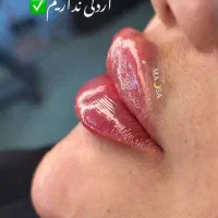 تزریق ژل و بوتاکس تضمینی|خدمات آرایشگری و زیبایی|قرچک, مهدیه|دیوار