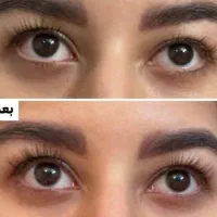 سرم مژه معجزه گر|آرایشی، بهداشتی، درمانی|اصفهان, گلستان|دیوار
