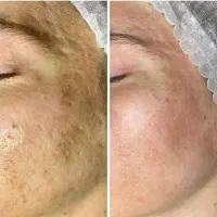 فیشال و پاکسازی با قیمت اقتصادی