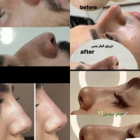 تخفیفات فقط تا آخر شهریورماه.مشاوره رایگان|خدمات آرایشگری و زیبایی|یاسوج, |دیوار
