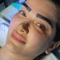 کاشت ابرو ۱۱۹۰۰ و بلفارو  8900