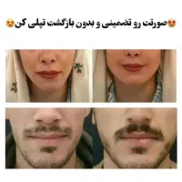 تپلی صورت