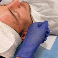 پاکسازی و فیشال پوست اقایان و بانوان