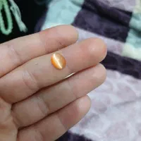 سنگ چشم گربه