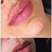 ژل \بوتاکس \لیزر مطب صدف (رویال سابق)