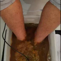 حجامت و زالوتراپی و طب سوزنی‌و پاکسازی بدن از سمو|خدمات آرایشگری و زیبایی|ارومیه, |دیوار