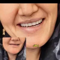 دندانسازی یزدی (قرارداد با بیمه )|خدمات آرایشگری و زیبایی|شیراز, دارالرحمه|دیوار