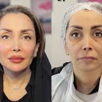 کلینیک تخصصی پوست نخ هایفو آموزش ژل بوتاکس بی رقیب|خدمات آرایشگری و زیبایی|تهران, زعفرانیه|دیوار