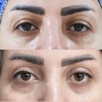 بلفارو پلک فیلر ژل لب ساکشن غبغب بوتاکس نخ سانترال|خدمات آرایشگری و زیبایی|اصفهان, مرداویج|دیوار