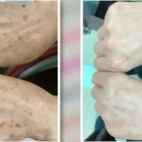 ارایشی|آرایشی، بهداشتی، درمانی|بندرعباس, |دیوار