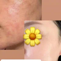 صابون سفید کننده و ضد لک