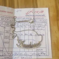 طلا