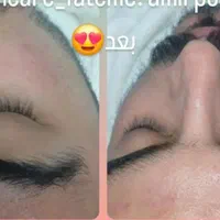 اموزش فیشال وکربوکسی و میکرونیدلینگ|خدمات آموزشی|یزد, |دیوار