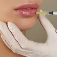 مدل تزریق فیلر