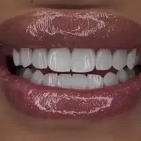 دندان مصنوعی تحویل( ۵ساعته)،کامپوزیت دندان ، روکش|خدمات آرایشگری و زیبایی|تهران, میدان ولیعصر|دیوار