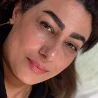کلینیک تخصصی کاشت ابرو (تخفیف ویژه و شرایط اقساط)|خدمات زیبایی و سلامت|رشت, گلسار|دیوار