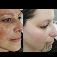 کرم سفید کننده و ضد لک ضد پیری رفع چروک جوش پوست|آرایشی، بهداشتی، درمانی|تهران, کامرانیه|دیوار