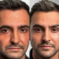 تخفیف به مناسبت روز مادر /ژل لب- کانتورینگ- بوتاکس|خدمات آرایشگری و زیبایی|مشهد, ایثار|دیوار