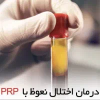 درمان فوری زود انزالی آقاوخانم افزایش سایزآقایان