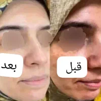 میخوای ۳روزه صورتت و بدنت سفید برفی شه ای کرم بزن|خدمات آرایشگری و زیبایی|ایذه, |دیوار
