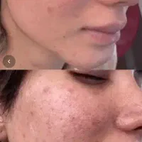 آف ویژه خدمات پوست و مو