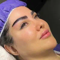 کاشت تخصصی ابرو در قزوین