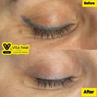 پاک کردن هاشورابرو،خطچشم،لب، درمطب پزشک|خدمات آرایشگری و زیبایی|اقلید, |دیوار