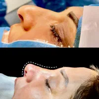 عمل بینی با شرایط ویژه(ماهانه ۱۰تومن)|خدمات آرایشگری و زیبایی|مهاباد (آذربایجان غربی), |دیوار