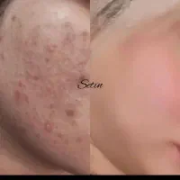 معجزه زیبایی|آرایشی، بهداشتی، درمانی|بروجن, |دیوار