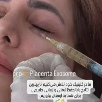 جشنواره پاییزه جوانسازی پوست فیشال پی ارپی اگزوزم