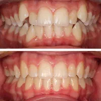 دندانپزشکی گران نیست، غفلت گران است(نقد اقساط)|خدمات آرایشگری و زیبایی|شیراز, گلدشت معالی‌آباد|دیوار
