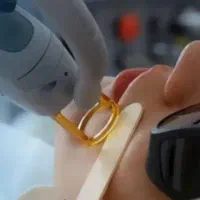 لیزر کندلا با بهترین قیمت