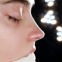 جراحی بینی به سبک جدید توسط فوق تخصص