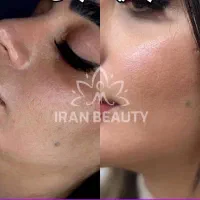 جوانسازی پوست همه‌کاره