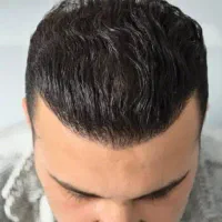 کلینیک کاشت مو|خدمات آرایشگری و زیبایی|مریوان, |دیوار