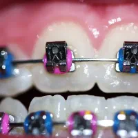 ارتودنسی اقساط،بهترین ارتودنسی مشهد و خراسان