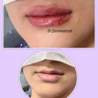 جشنواره پاییزی زیبایی در کلینیک ما آغاز شد...|خدمات آرایشگری و زیبایی|زاهدان, |دیوار